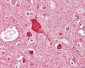 ABCA2 Antibody (Internal)